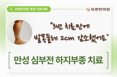 만성 심부전 하지부종 치료(70대, 남성)