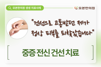 건선 치료(40대, 남성)